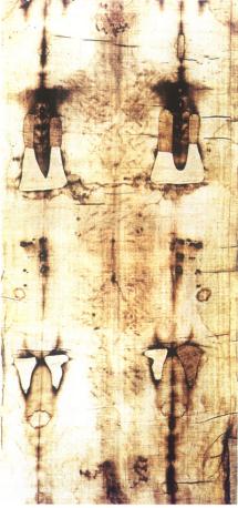 les traces de flagellation sur le dos les traces de flagellation sur le dos